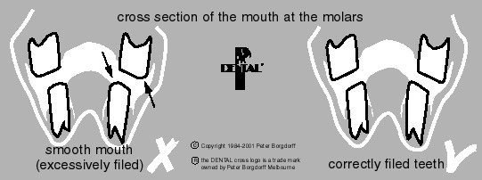 CrossSectionSmoothMouth